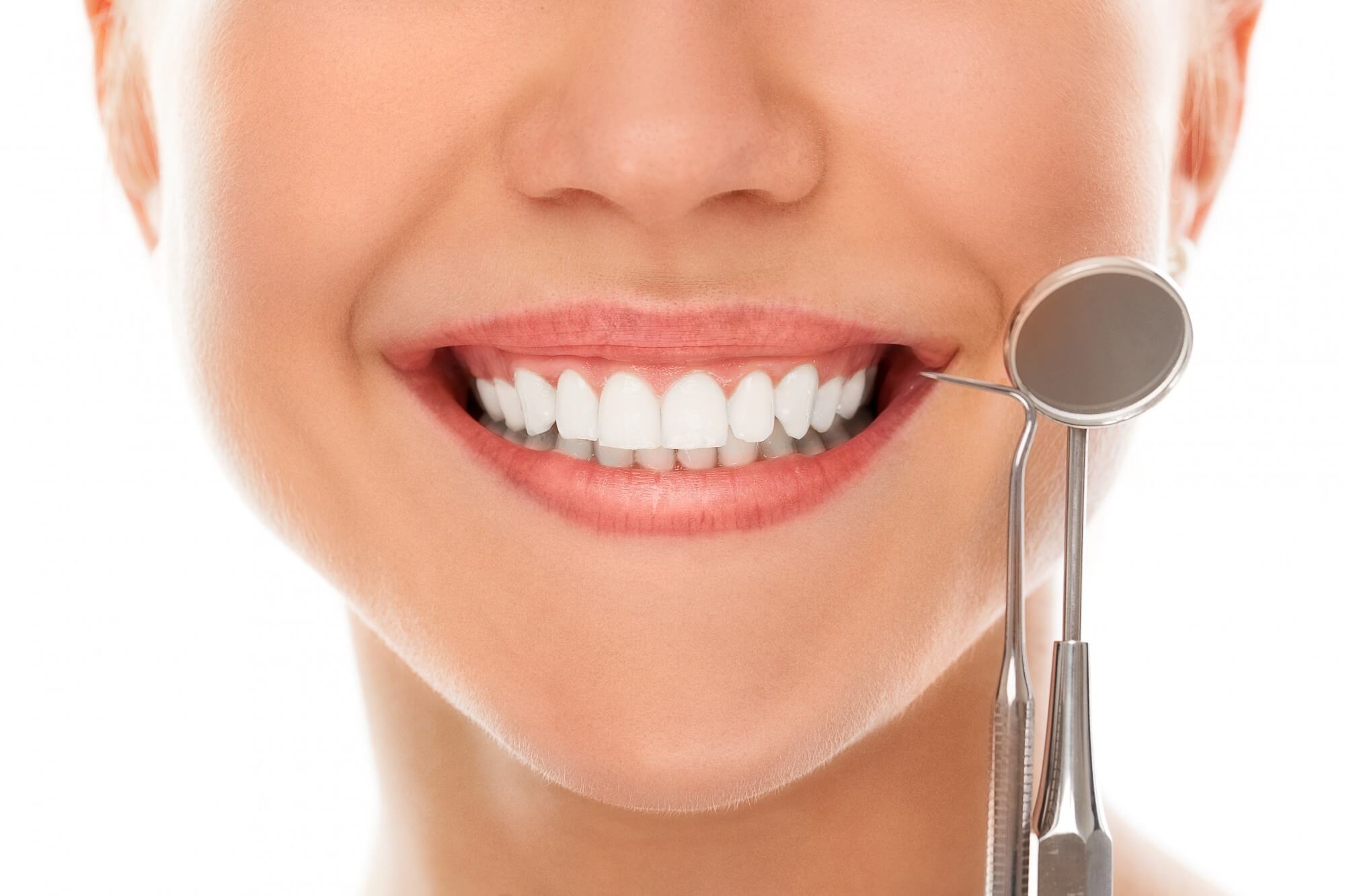 Clareamento dental: veja o que você precisa saber